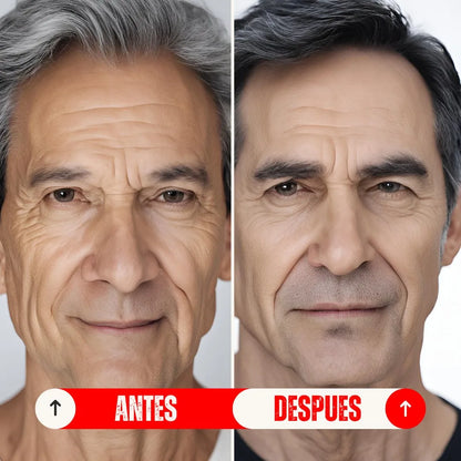 Jabon Antigray Anticanas