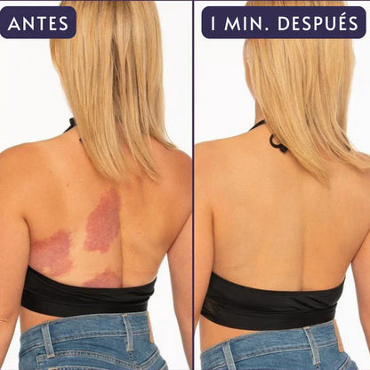 GlowDrop™ - Corrector Hidratante corporal Tono Claro