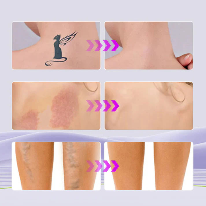 GlowDrop™ Corrector Hidratante corporal